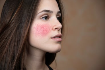 ¿Cómo tratar las infecciones en tejidos blandos?