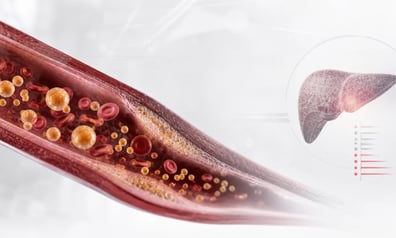 Redefiniendo el riesgo cardiovascular con la ApoB en el paciente cardiometabólico ¿la ApoB, debe ser una diana terapéutica?