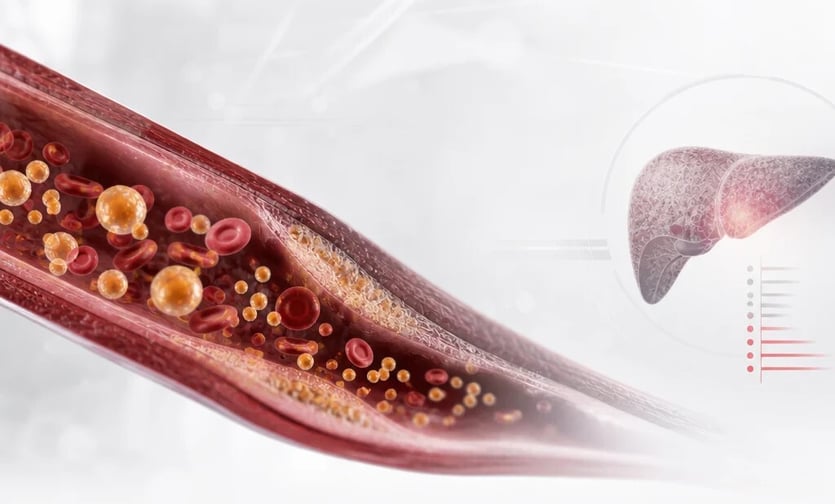 Redefiniendo el riesgo cardiovascular con la ApoB en el paciente cardiometabólico ¿la ApoB, debe ser una diana terapéutica?