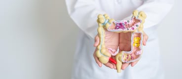 Microbioma intestinal: clave en la respuesta a inmunoterapia oncológica