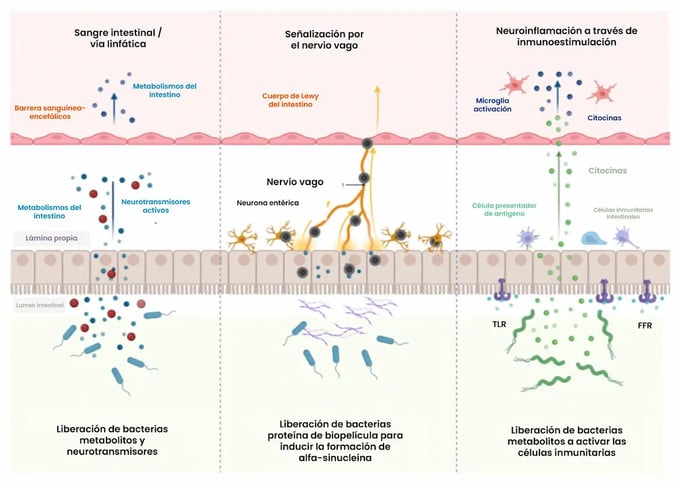 Interacción del eje intestino-cerebro como etiología de la génesis de la enfermedad de Parkinson