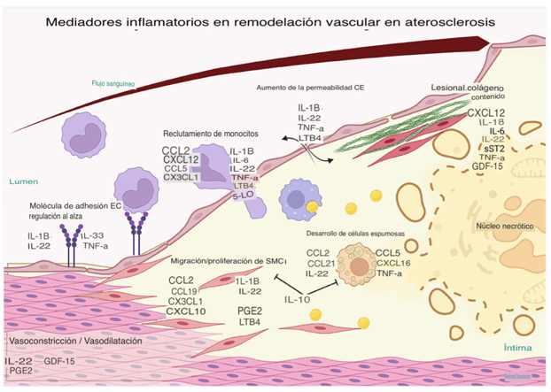 Modelo de remodelación vascular en ateroesclerosis